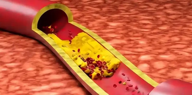 ARA-290 blood | Shaanxi BLOOM Tech Co., Ltd ARA-290 blood | Shaanxi BLOOM Tech Co., Ltd